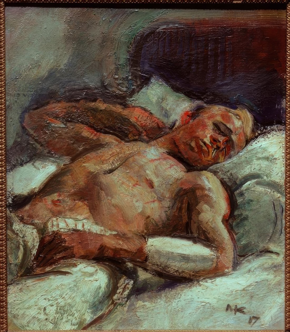 Ferito da Anton Kolig