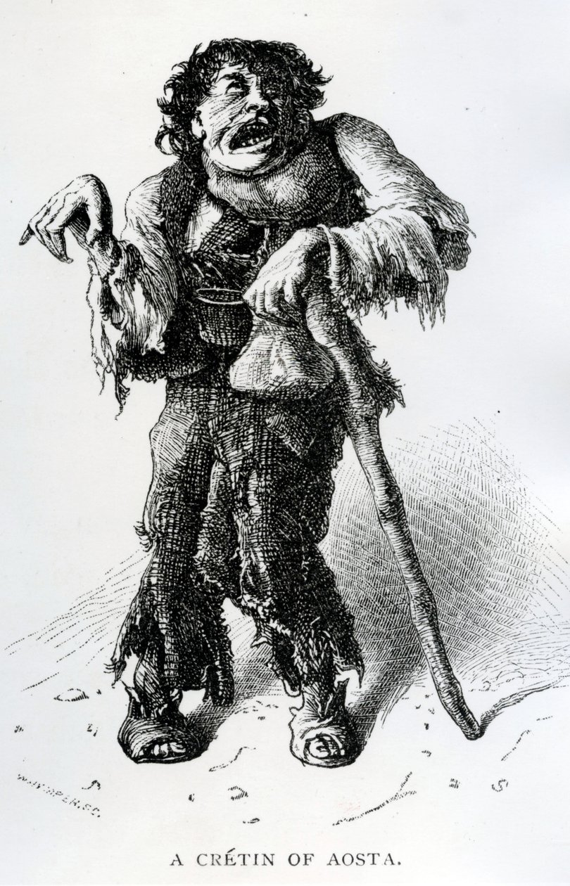 Un cretino di Aosta, c.1870 da Edward Whymper