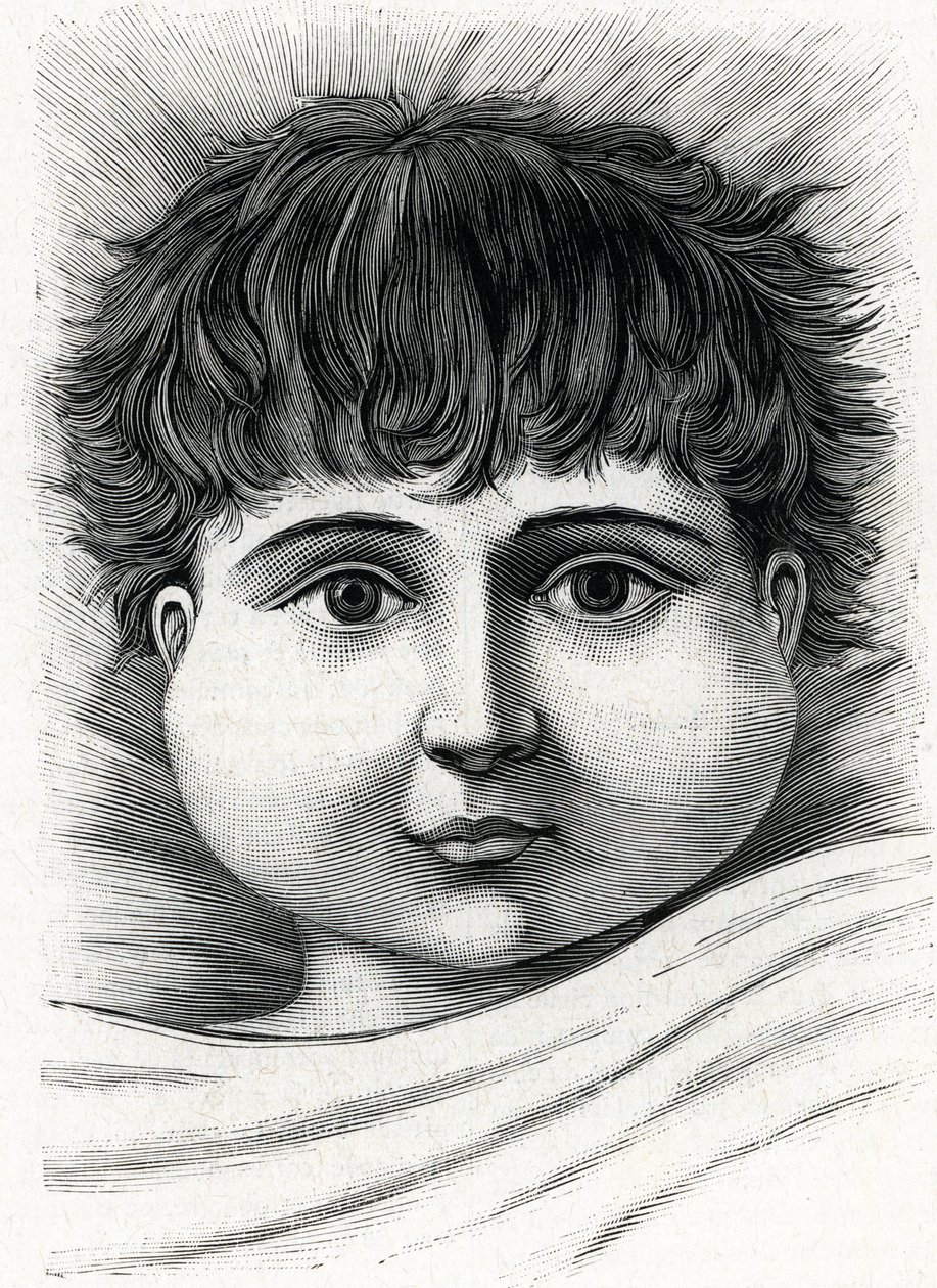 Bambino con parotite (incisione) da French School
