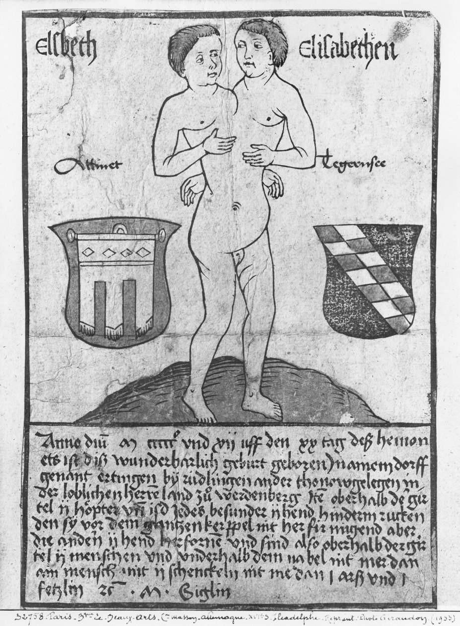 Ragazze siamesi, Elsbeth ed Elisabethen (xilografia e acquerello) da German School