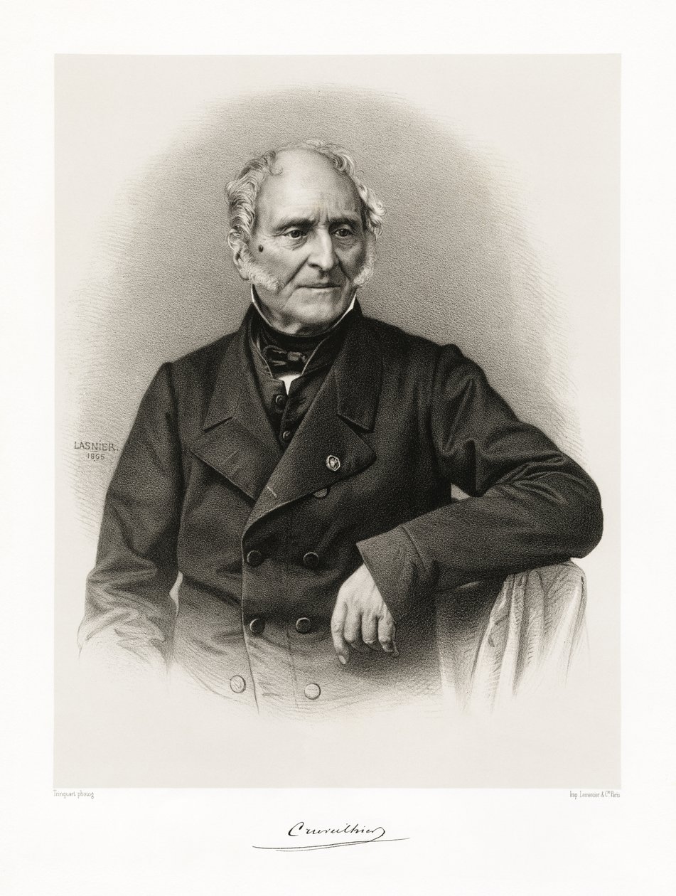 Jean Cruveilhier da Lasnier