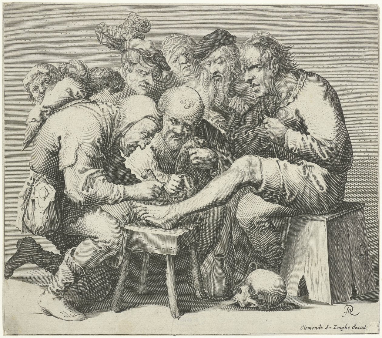 Operazione al piede da Pieter Jansz Quast