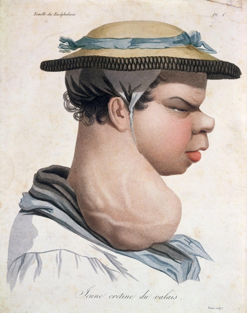 Giovane Cretino del Vallese, illustrazione da un libro di Baron Jean Louis Alibert da Salvadore Tresca
