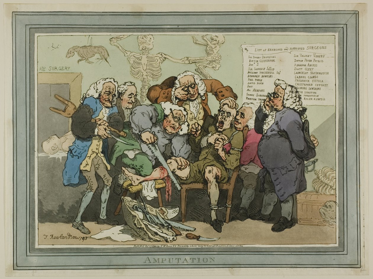 Amputazione da Thomas Rowlandson