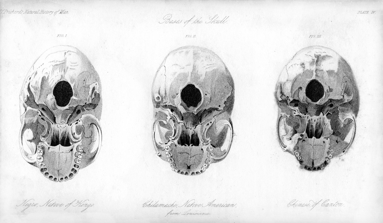 Base del cranio da Unbekannt