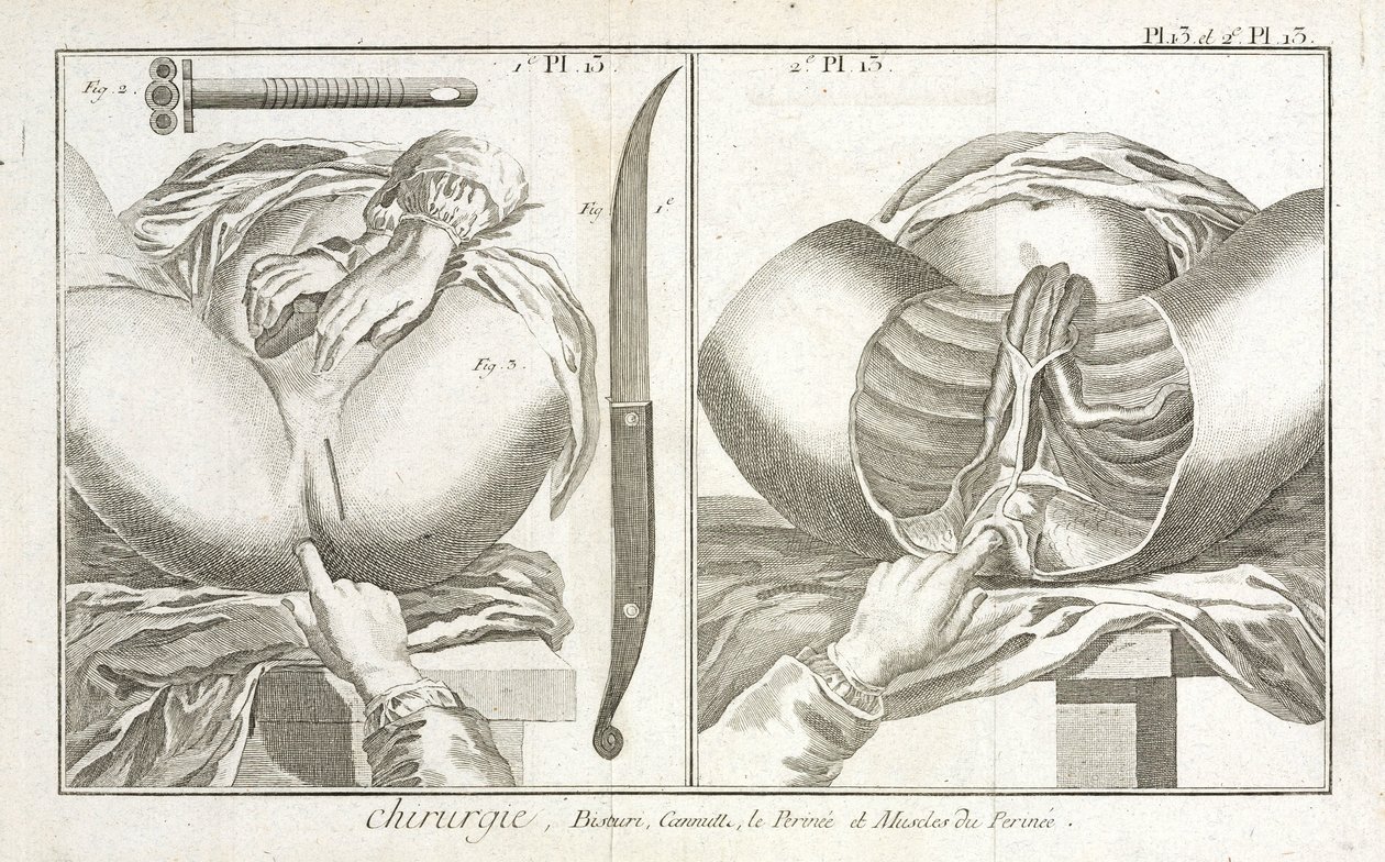 Attrezzature, epoca moderna da Unbekannt