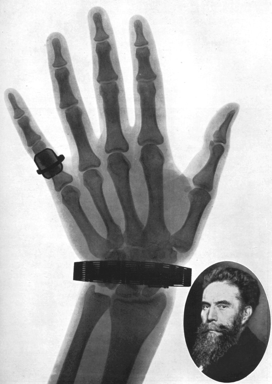 Radiografia di una mano, 1926 da Unbekannt