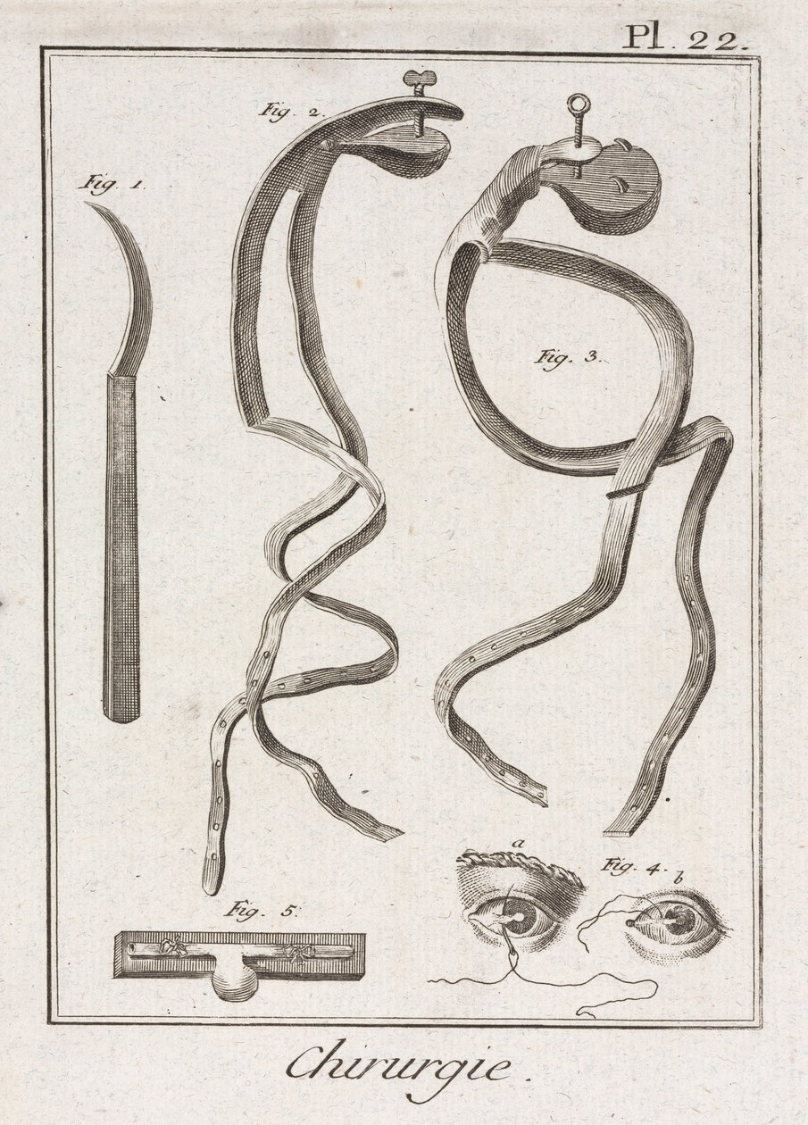 Chirurgia oculare dell