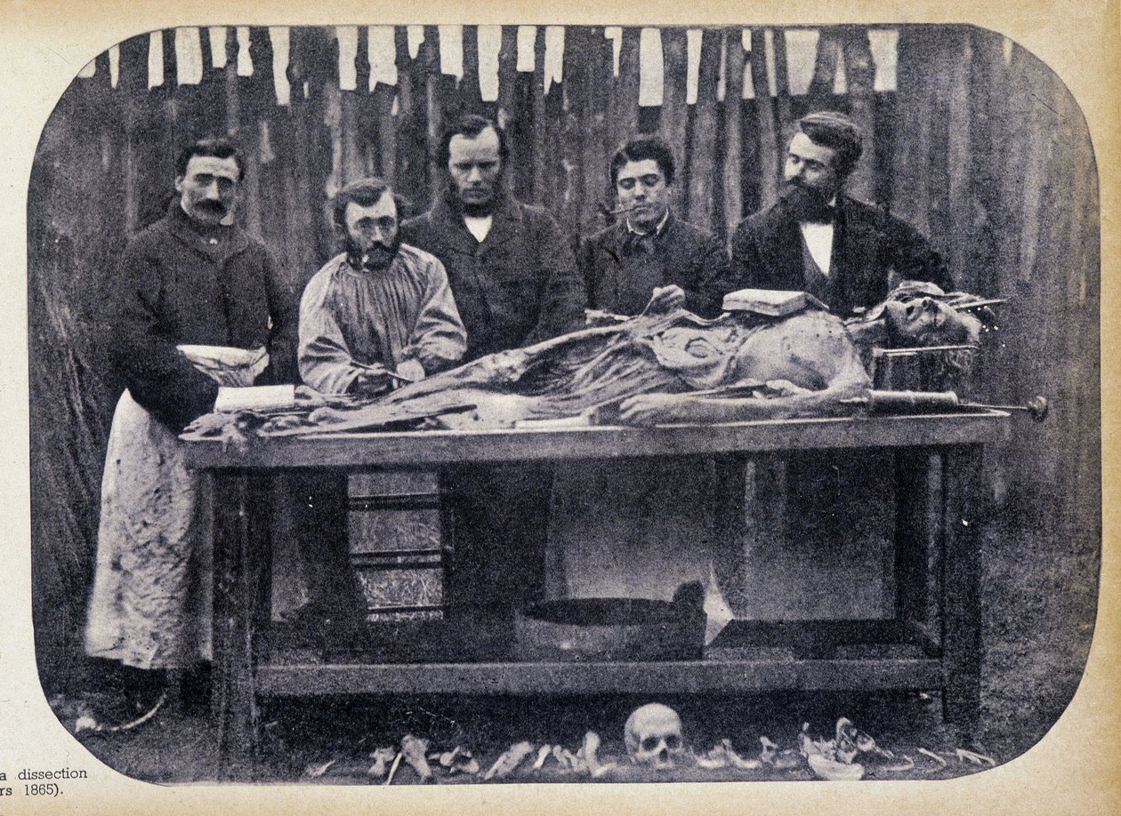 Dissezione, c.1865 da Unknown photographer
