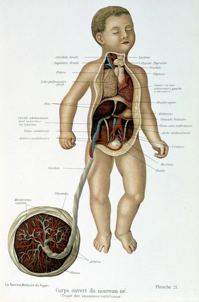 Medicina: neonato (spellato nel busto) da Unknown artist