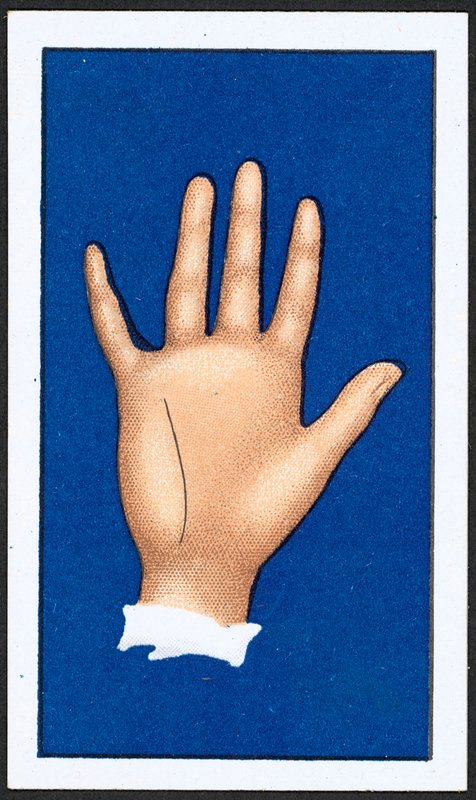 Linea dell