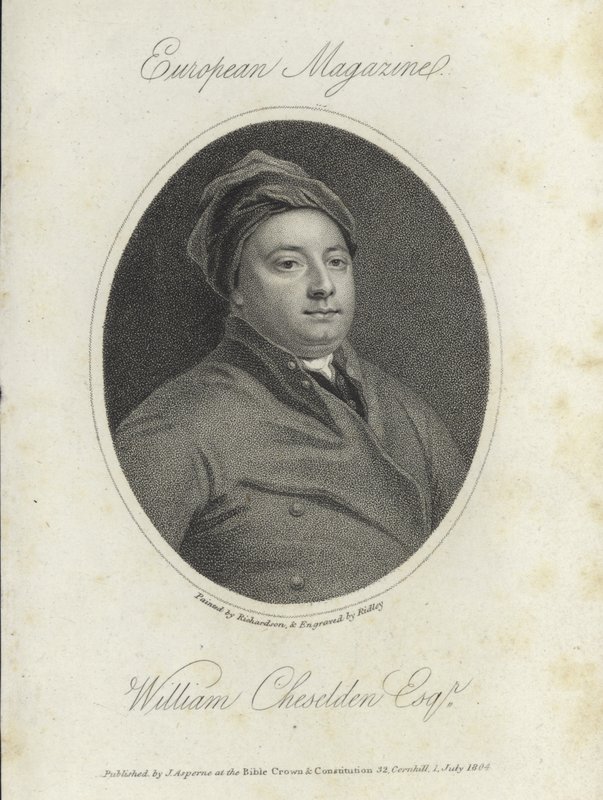 William Cheselden da English School