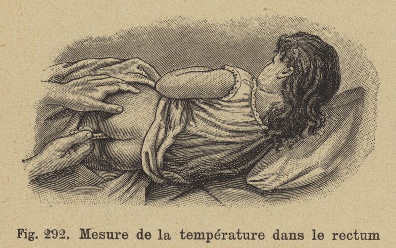 Misurazione della temperatura di un bambino dal retto da German School
